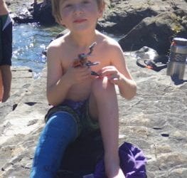Helping a Child Recover After a Broken Leg: A Parent’s Perspective