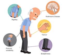drawing of person with symptoms of Parkinson in bubble around person