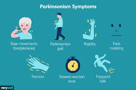 image of Parkinson symptoms